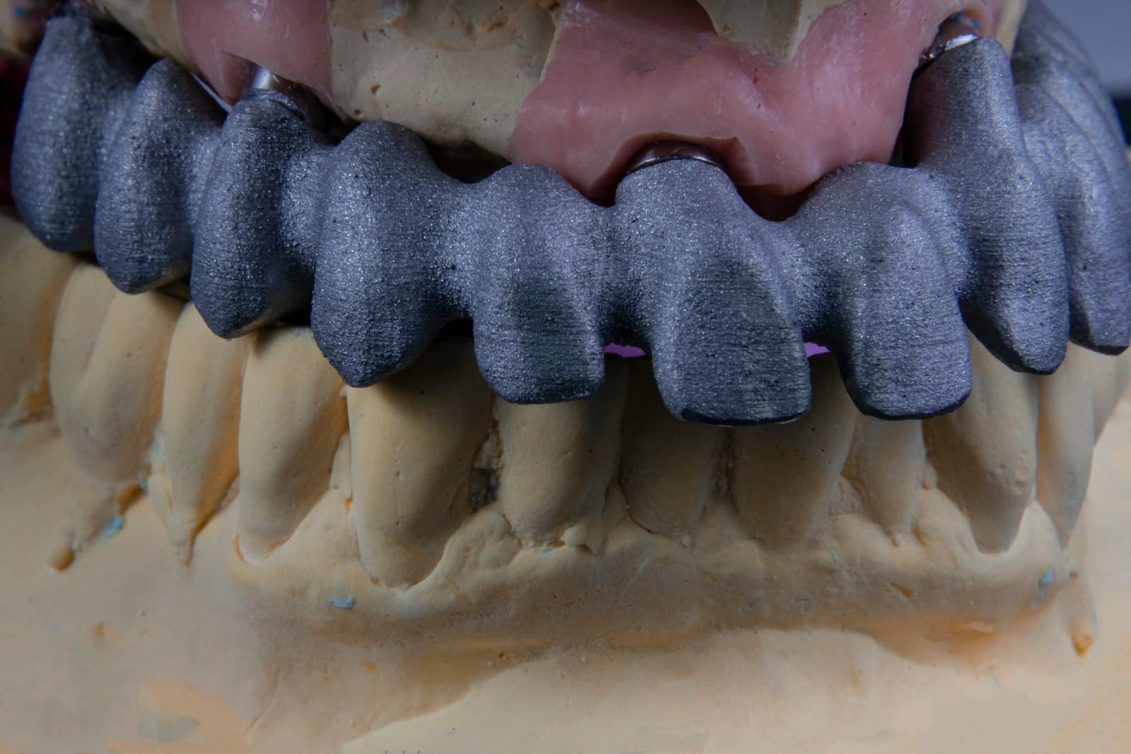 Macro detail of a dental model
